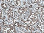 VEGF Antibody in Immunohistochemistry (Paraffin) (IHC (P))