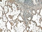 VEGF Antibody in Immunohistochemistry (Paraffin) (IHC (P))