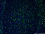 NOX2 Antibody in Immunohistochemistry (PFA fixed) (IHC (PFA))