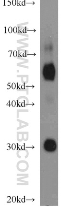 NOX2 Antibody in Western Blot (WB)