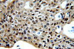 CDK1 Antibody in Immunohistochemistry (Paraffin) (IHC (P))