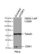 CDK1 Antibody in Western Blot (WB)