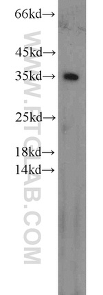 CDK1 Antibody in Western Blot (WB)