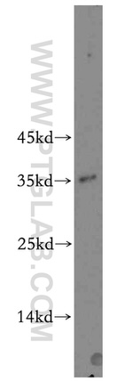 CDK1 Antibody in Western Blot (WB)