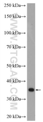 CDK1 Antibody in Western Blot (WB)