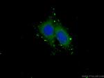 GSDMD Antibody in Immunocytochemistry (ICC/IF)