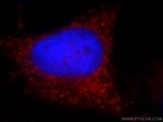 GSDMD Antibody in Immunocytochemistry (ICC/IF)