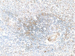 IL-6 Antibody in Immunohistochemistry (Paraffin) (IHC (P))