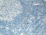 IL-6 Antibody in Immunohistochemistry (Paraffin) (IHC (P))