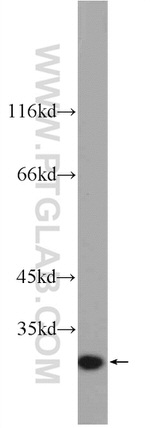 IL-6 Antibody in Western Blot (WB)