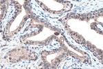 PPAR Gamma Antibody in Immunohistochemistry (Paraffin) (IHC (P))