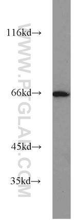 PPAR Gamma Antibody in Western Blot (WB)