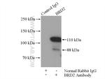 BRD2 Antibody in Immunoprecipitation (IP)