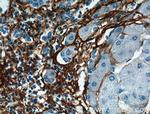 Collagen Type III (N-terminal) Antibody in Immunohistochemistry (Paraffin) (IHC (P))