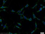 Caspase 1/p20/p10 Antibody in Immunocytochemistry (ICC/IF)