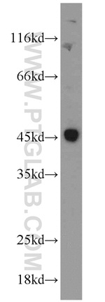 Caspase 1/p20/p10 Antibody in Western Blot (WB)