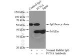 PCNA Antibody in Immunoprecipitation (IP)