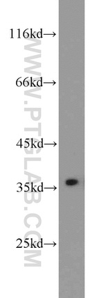 PCNA Antibody in Western Blot (WB)