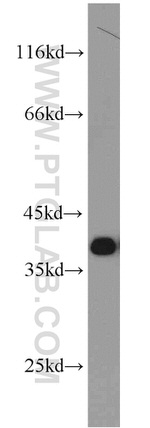 PCNA Antibody in Western Blot (WB)