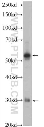 XBP1S Antibody in Western Blot (WB)