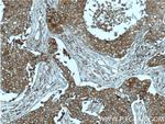 c-Met (Cytoplasmic) Antibody in Immunohistochemistry (Paraffin) (IHC (P))