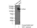 c-Met (Cytoplasmic) Antibody in Immunoprecipitation (IP)