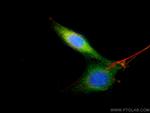 Bcl2 Antibody in Immunocytochemistry (ICC/IF)