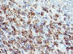 Bcl2 Antibody in Immunohistochemistry (Paraffin) (IHC (P))