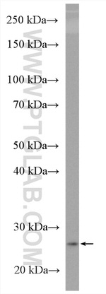 Bcl2 Antibody in Western Blot (WB)