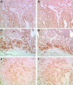 Cyclin D1 Antibody in Immunohistochemistry (IHC)