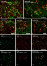 Connexin 26 Antibody in Immunohistochemistry (IHC)