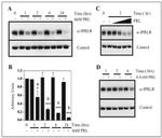 Prolactin Receptor Antibody in Western Blot (WB)