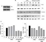 Prolactin Receptor Antibody in Western Blot (WB)