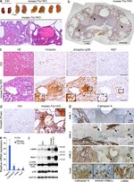 Ki-67 Antibody in Immunohistochemistry (Paraffin) (IHC (P))