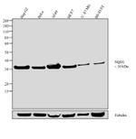 NQO1 Antibody in Western Blot (WB)