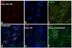 Ki-67 Antibody