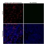 Ki-67 Antibody in Immunohistochemistry (Paraffin) (IHC (P))