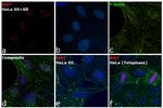 Ki-67 Antibody