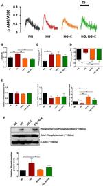 Phospholamban Antibody in Western Blot (WB)