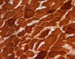 SDHA Antibody in Immunohistochemistry (Frozen) (IHC (F))