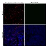 Ki-67 Antibody in Immunohistochemistry (Paraffin) (IHC (P))