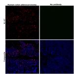 Ki-67 Antibody in Immunohistochemistry (Paraffin) (IHC (P))