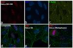 Ki-67 Antibody