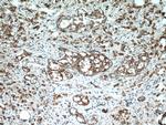 beta-Catenin Antibody in Immunohistochemistry (Paraffin) (IHC (P))