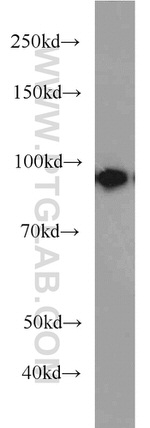 beta-Catenin Antibody in Western Blot (WB)