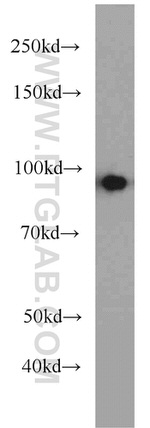 beta-Catenin Antibody in Western Blot (WB)