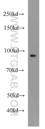 beta-Catenin Antibody in Western Blot (WB)