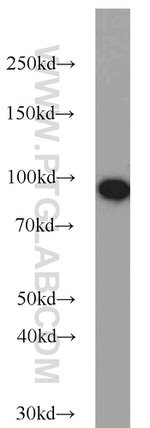 beta-Catenin Antibody in Western Blot (WB)