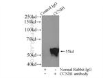 Cyclin B1 Antibody in Immunoprecipitation (IP)