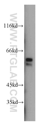 Cyclin B1 Antibody in Western Blot (WB)